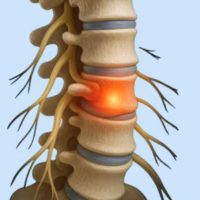 Ukočenost nakon buđenja