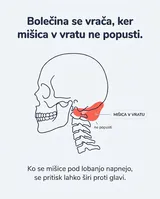 Prikaz mišice v vratu, ki lahko širi pritisk proti glavi